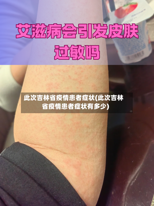此次吉林省疫情患者症状(此次吉林省疫情患者症状有多少)-第1张图片